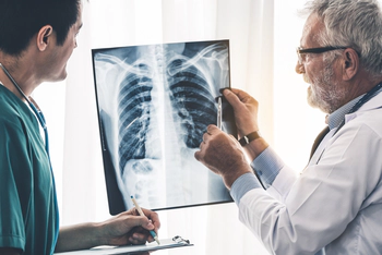 Senior male doctor looking at x-ray film of patient chest injury while working with another doctor at the hospital.